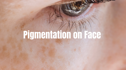 Pigmentation on Face